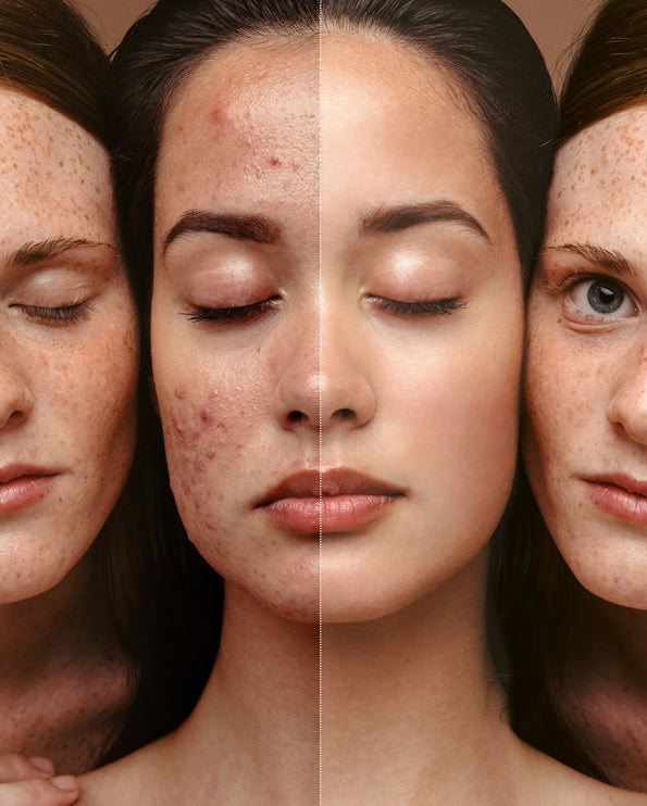 F84 Blemish Control Gesichtsmaske